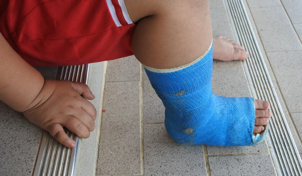 Еңбекшіқазақта баласының аяғына гипс салдырғысы келмеген әке үш күнге қамалды