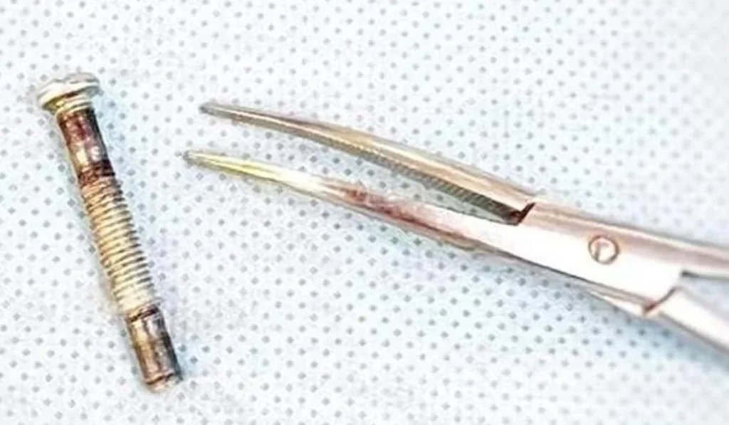 Түркістан облысында бір жасар сәби темір болт жұтып қойған