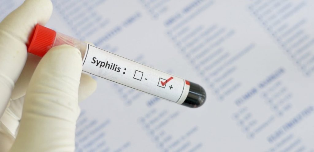 Германияда мерез инфекциясын жұқтырғандардың саны күрт асты