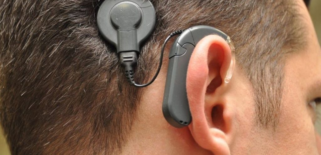 Мүгедектігі жоқ адамдар да медициналық көрсетілімдер бойынша есту протезімен тегін қамтылмақ