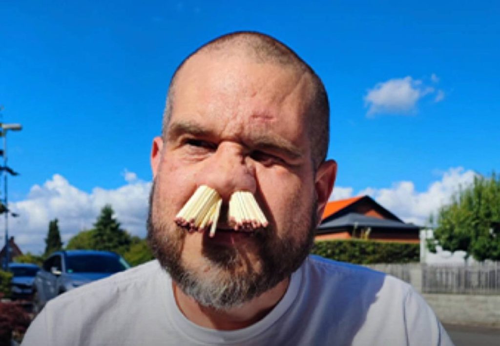 Отцовская амбиция: Швед Мартин Стребю вставил 81 спичку в ноздри ради детей