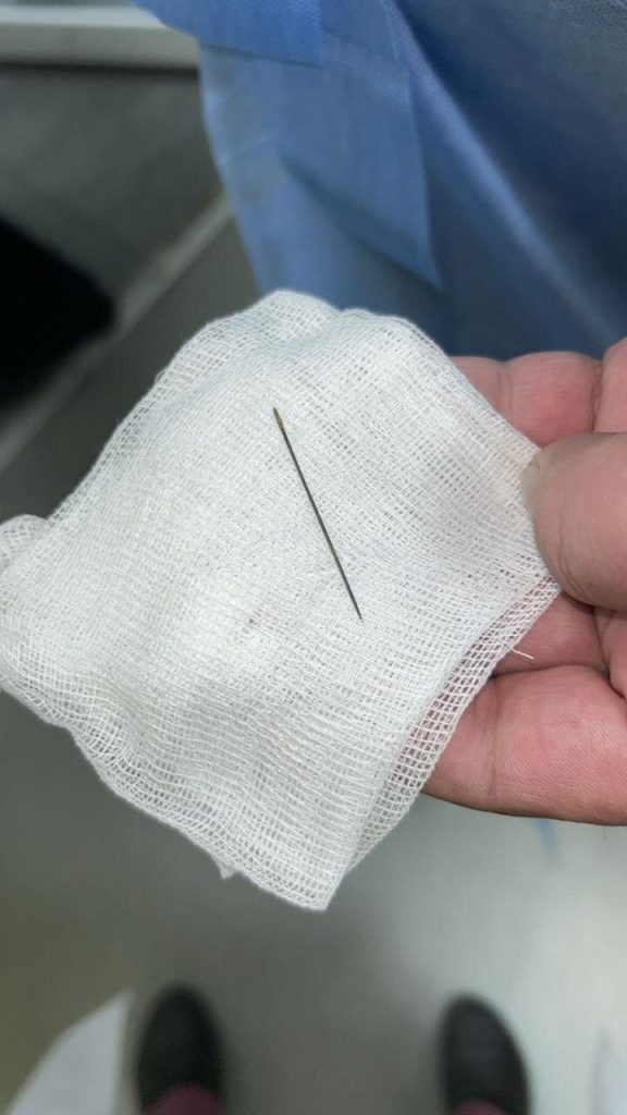 баланың ішіндегі ине