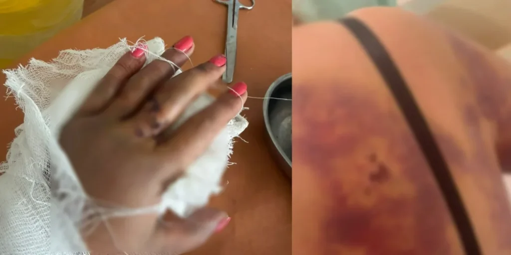 Жетісуда мас тұрғын көрші әйелді күрекпен аяусыз ұрған Көршісін күрекпен ұрған